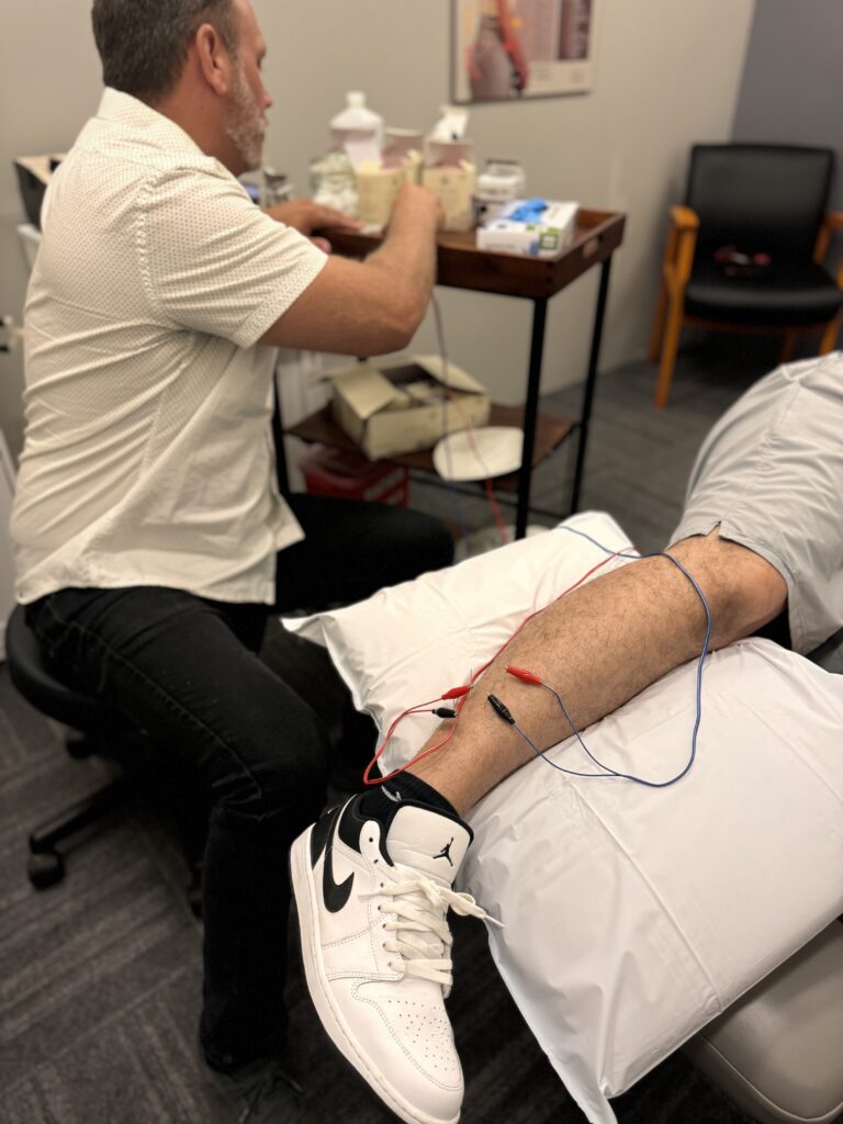 dry needling